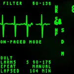 Hvordan kan jeg aflæse og forstå resultaterne fra pulsoximeteret?